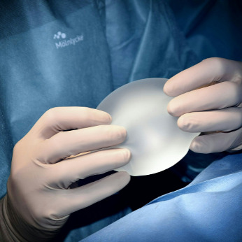 Implants mammaires : placement prépectoral ou sous-pectoral?